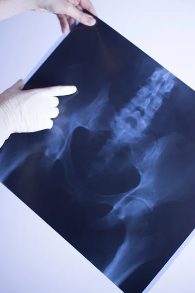 Ortopédiai magánrendelés része a képalkotó diagnosztika